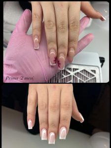 refill gel correttivo